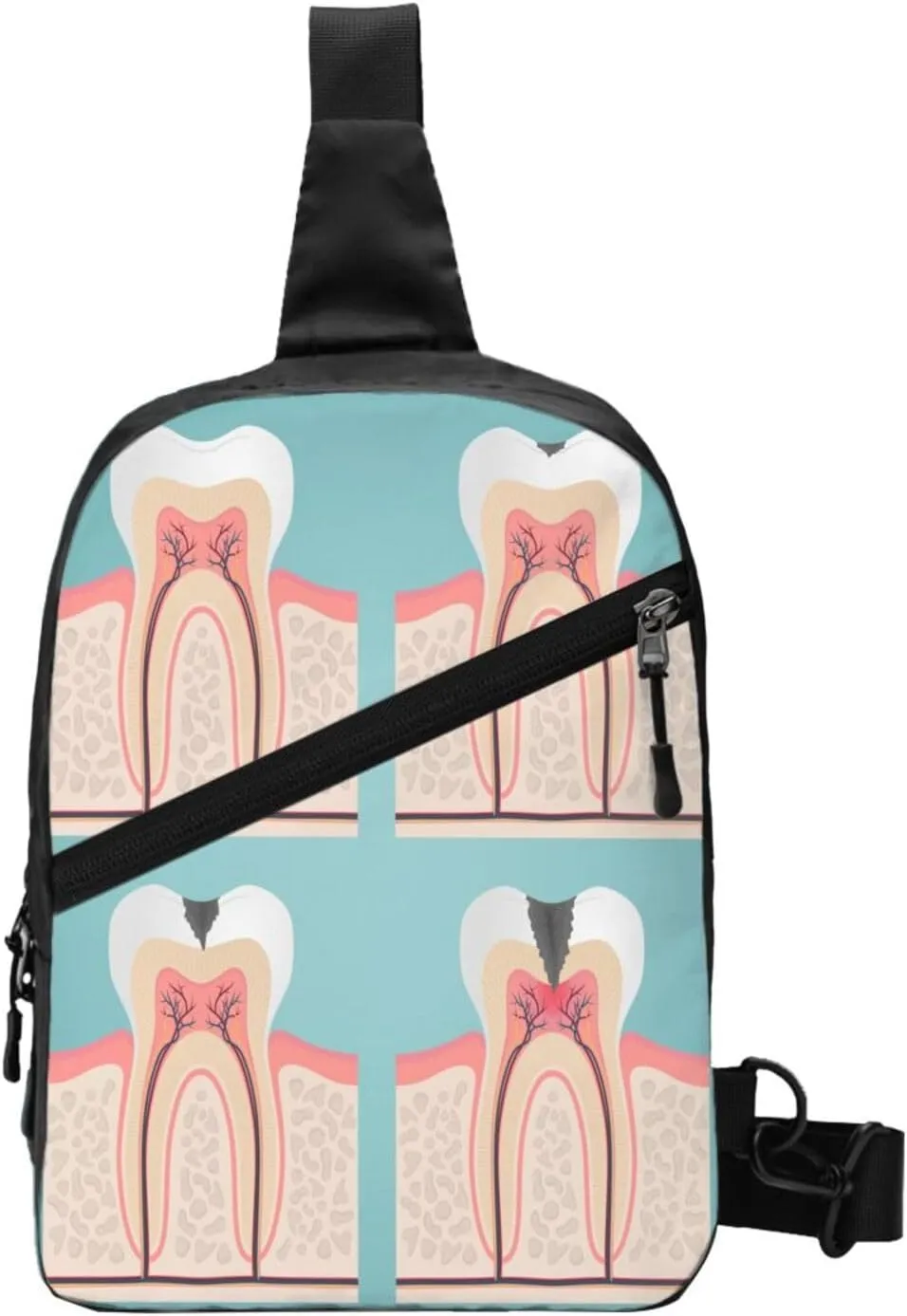 Tooth Anatomy Cut Teeth Sling Bag for Men Women, Small Crossbody Sling Backpack Shoulder Chest Bag, Anti Theft Travel Hiking Sports